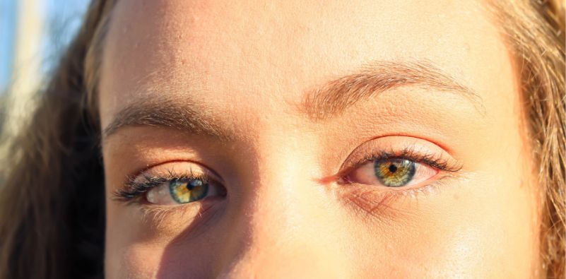 A close-up of a woman’s eyes under the sun